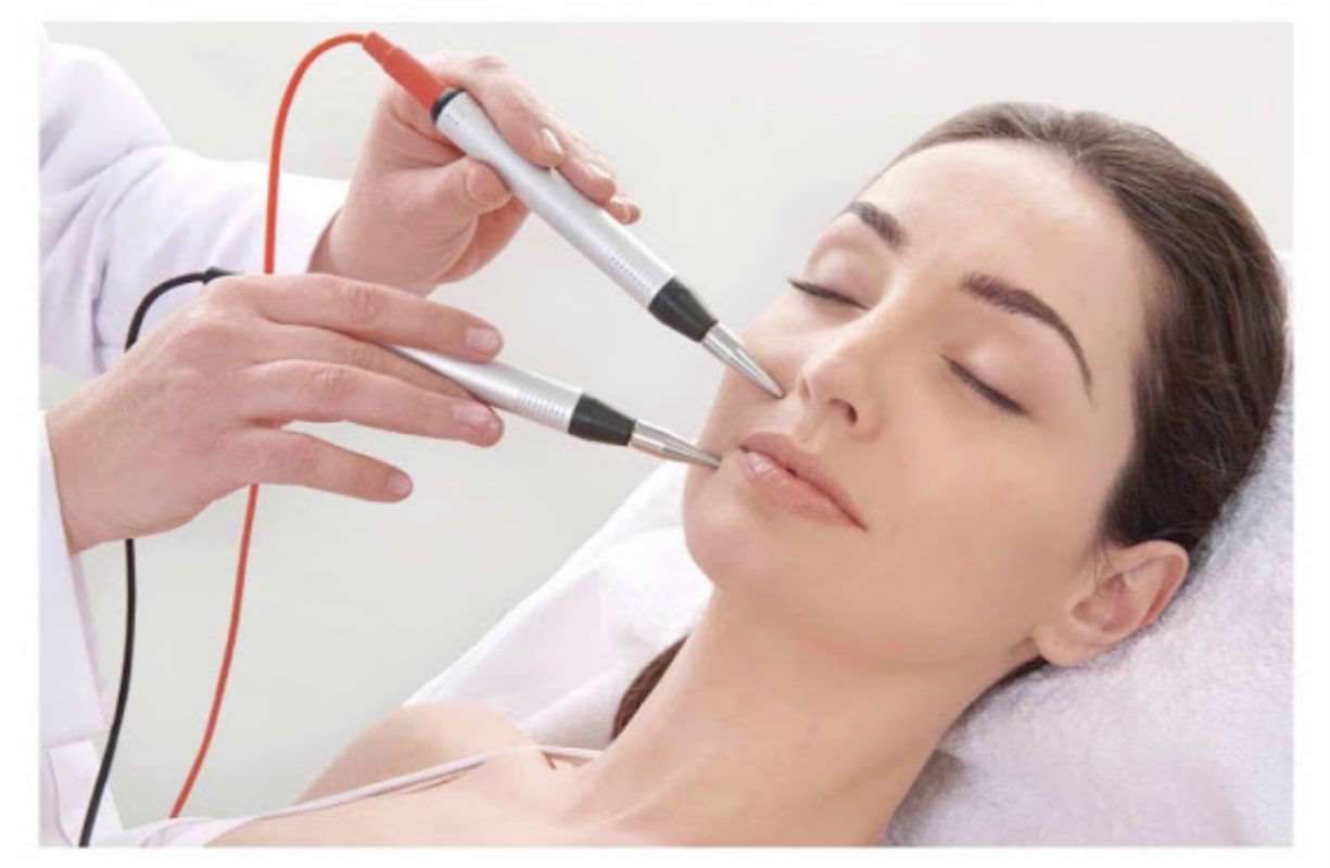 MESOSTIMOLAZIONE VISO